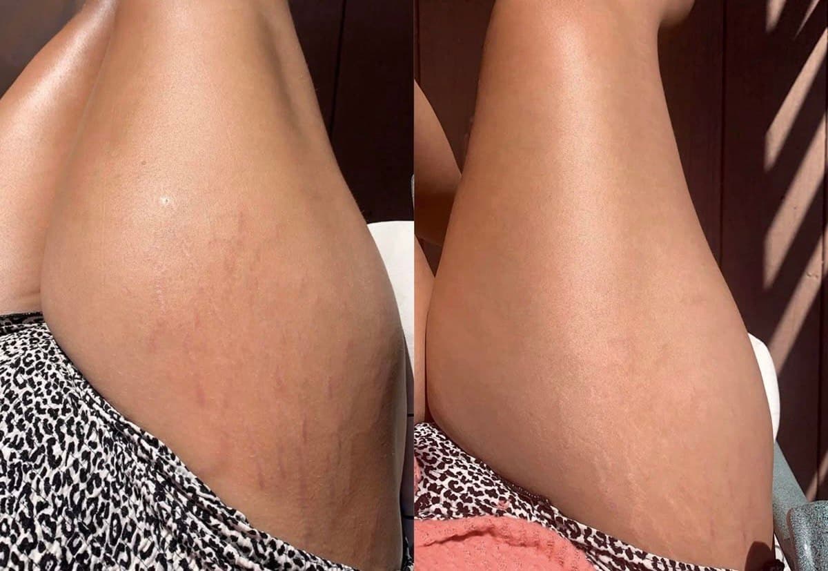 Femme sereine après sa douche